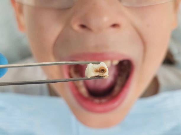 Best After-Hours Emergency Dentist in Fordyce, AR