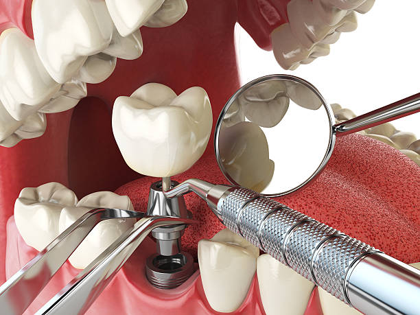 Best Emergency Wisdom Teeth Removal in Fordyce, AR